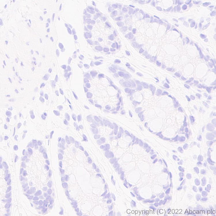 Anti-Strep-tag II antibody [EPR28119-43](AB307676)