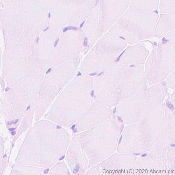 Bst2 Tetherin Antibody Epr23597 202 Bsa And Azide Free Ab272175  Immunohistochemistry Formalin Pfa Fixed Paraffin Embedded Sections Img104974