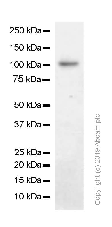 Anti-MSH2 antibody [SP46](AB231437)
