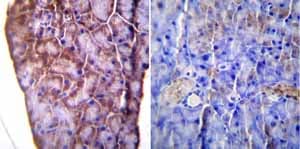 Kdel Antibody Ab2898  Immunohistochemistry Formalin Pfa Fixed Paraffin Embedded Sections Img97581