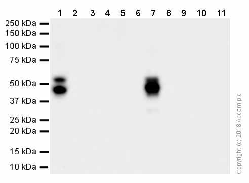 Anti-RAGE antibody [EPR21171](AB216329)