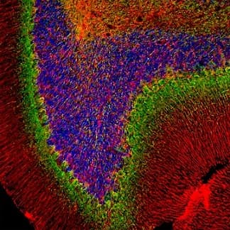 Alpha Internexin Antibody Ab7259  Immunohistochemistry Pfa Perfusion Fixed Frozen Sections Img133247