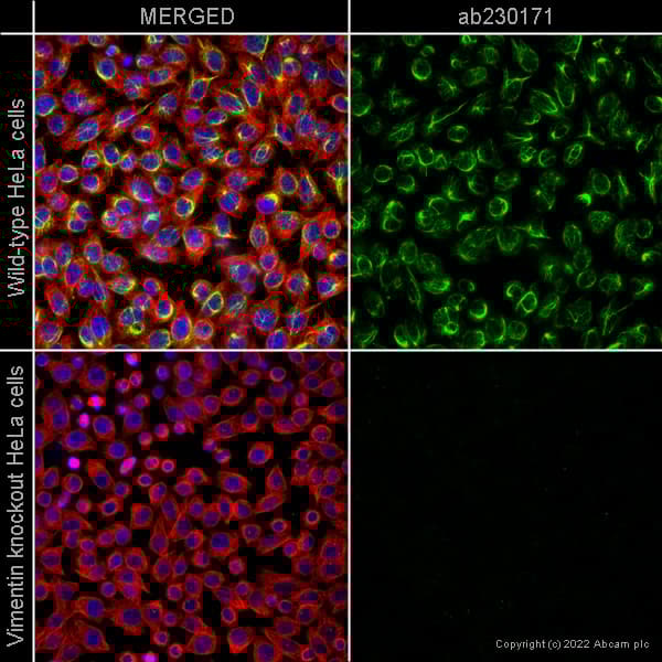 Anti-beta Tubulin antibody - Loading Control(AB6046)