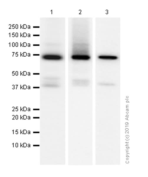 Syk Antibody Ep573y Ab40781  Western Blot Img12095