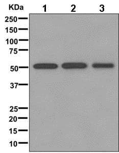 Npp 7 Antibody Epr12329 Bsa And Azide Free Ab249792  Western Blot Img70704