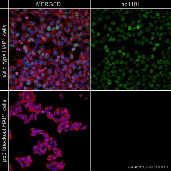 Anti-p53 antibody [DO-1] - ChIP Grade(AB1101)