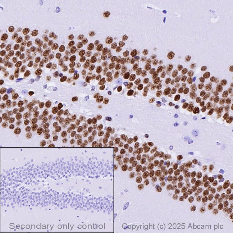 Anti-PROX1 antibody [EPR19273](AB199359)