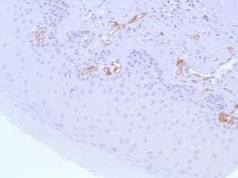 Anti-Nestin antibody [SP103](AB105389)