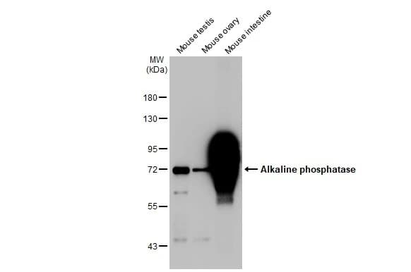 Anti-Alkaline phosphatase antibody [HL1267](ab308353)