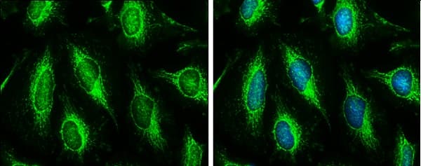 Anti-Hexokinase II antibody(AB227198)