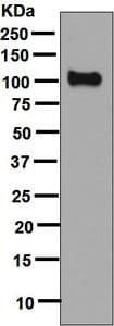 Psma Antibody Epr6253 Ab133579  Western Blot Img81951