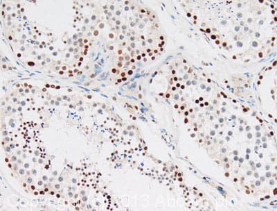 Anti-Histone H3 antibody(AB18521)
