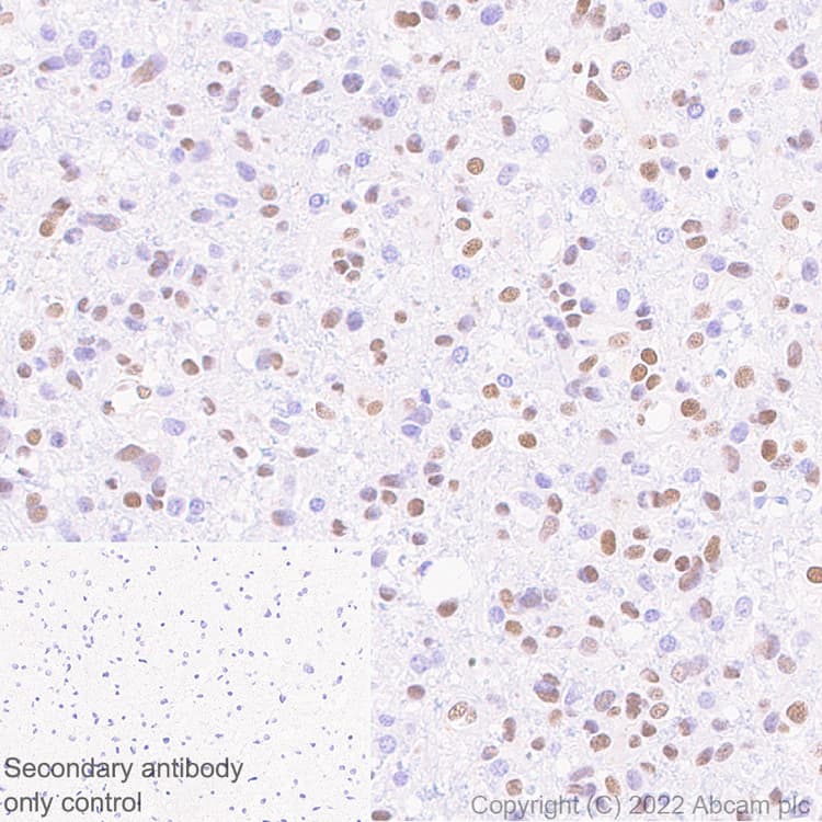 Anti-ZEB1 antibody [EPR26184-63] - BSA and Azide free(AB303481)