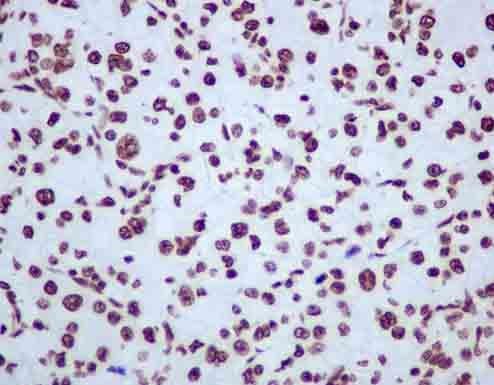 Hnrnp U P120 Antibody Epr122782b Bsa And Azide Free Ab250283  Immunohistochemistry Formalin Pfa Fixed Paraffin Embedded Sections Img102356