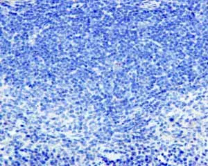 Anti-SNAP25 antibody [EP3274] - BSA and Azide free(AB226046)
