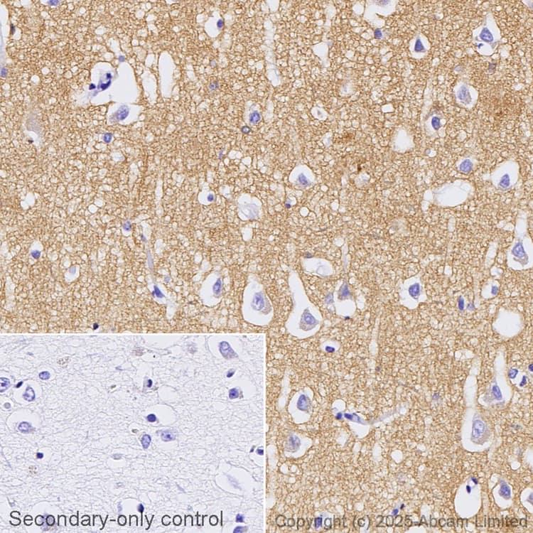 Snap25 Antibody Ep3274 Ab108990  Immunohistochemistry Formalin Pfa Fixed Paraffin Embedded Sections Img448181
