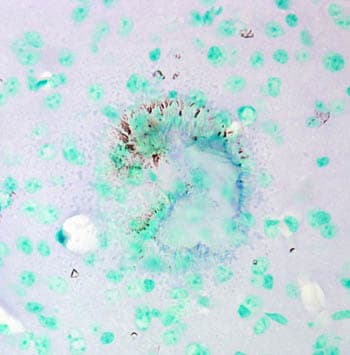 Anti-CACNA1C antibody [S57](AB84814)