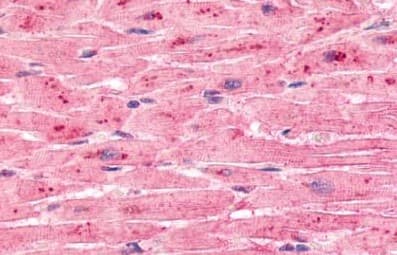 Etl Antibody Ab150489  Immunohistochemistry Formalin Pfa Fixed Paraffin Embedded Sections Img127584