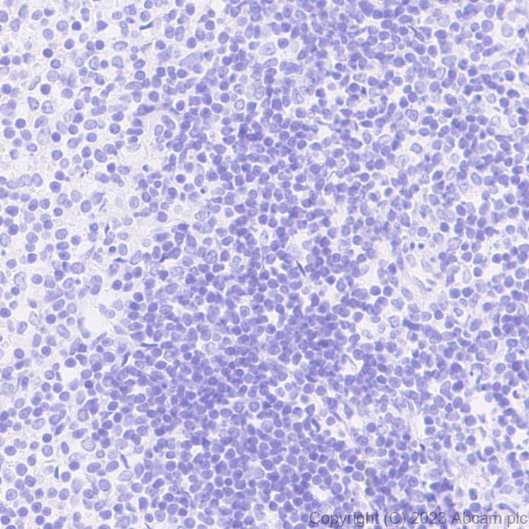 Anti-Aggrecan antibody [EPR28034-86](AB313636)