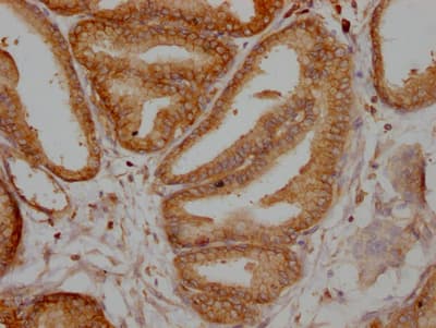 Tctp Antibody 10a9 Ab314167  Immunohistochemistry Formalin Pfa Fixed Paraffin Embedded Sections Img419577