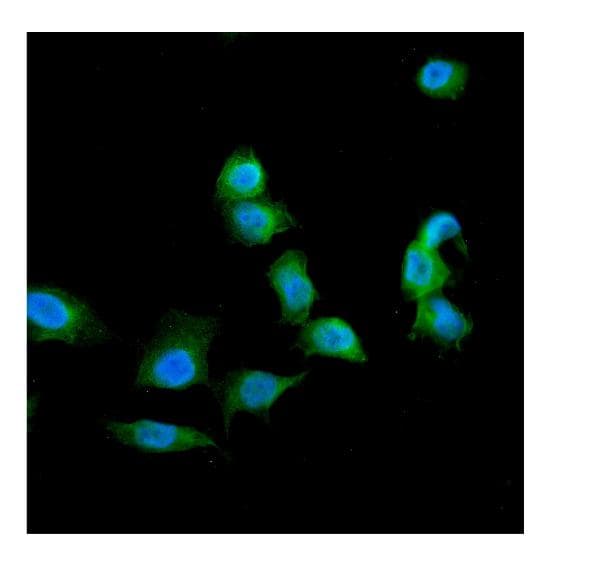 Galectin 1 Antibody Ab112525  Immunocytochemistry Img64374