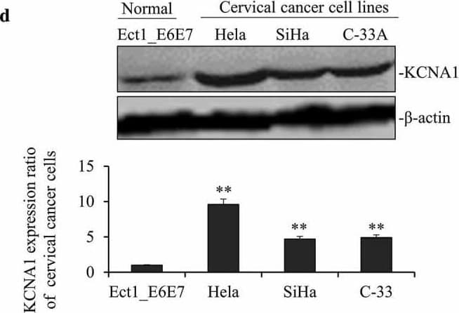 Anti-Mitochondria antibody [113-1] - BSA and Azide free(AB92824)