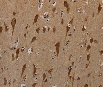 Pkmyt1 Antibody Ab200387  Immunohistochemistry Formalin Pfa Fixed Paraffin Embedded Sections Img29144