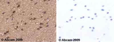 Serpinb2 Pai 2 Antibody Ab47742  Immunohistochemistry Formalin Pfa Fixed Paraffin Embedded Sections Img129428