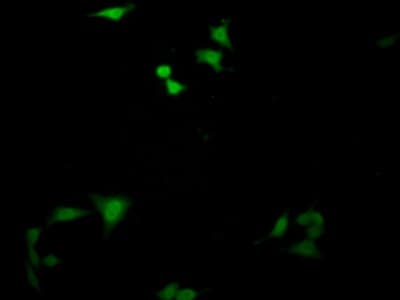 Anti-SMN/Gemin 1 antibody(AB232784)