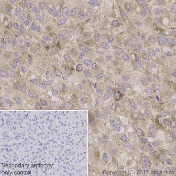 Anti-BDNF antibody [EPR1292](AB108319)
