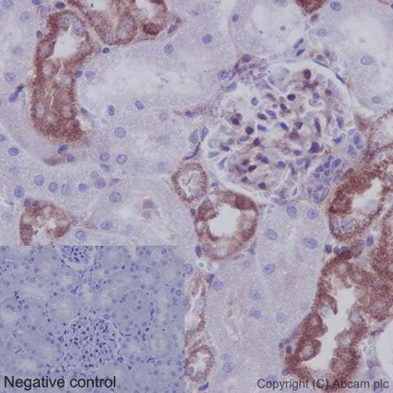 Anti-IKB alpha antibody [E130] - BSA and Azide free(AB215972)