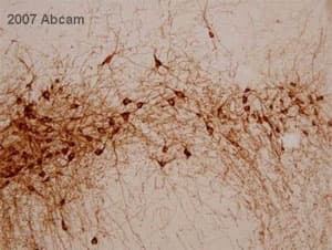 Anti-Tyrosine Hydroxylase antibody - Neuronal Marker(AB112)
