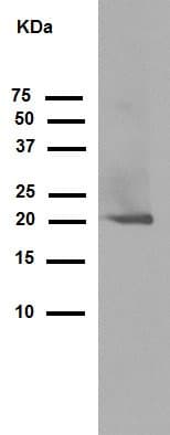 Dctn3 Antibody Epr5097 Ab124674  Western Blot Img82783