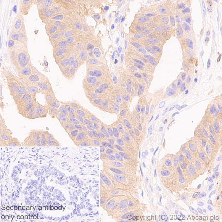 Anti-PAK1 antibody [EPR26067-45](AB302506)
