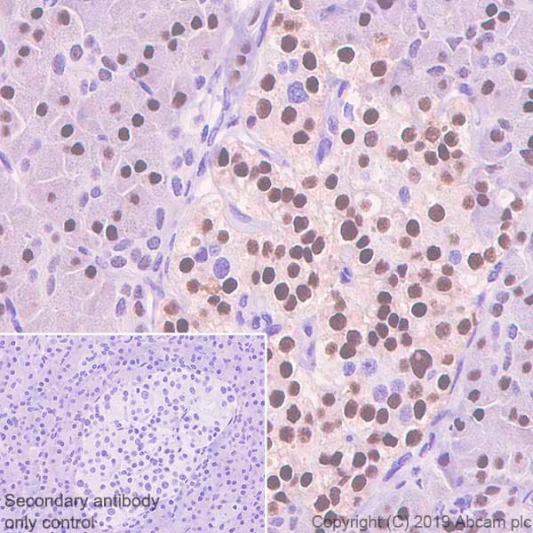 Hnf1 Alpha Antibody Epr23054 142 Ab242140  Immunohistochemistry Formalin Pfa Fixed Paraffin Embedded Sections Img103780