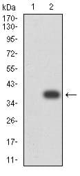 Baff R Antibody 5a9b6 Ab233775  Western Blot Img130936
