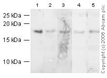 Anti-Histone H3 antibody(AB18521)
