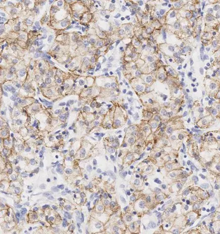 Anti-N Cadherin antibody - Intercellular Junction Marker(AB18203)