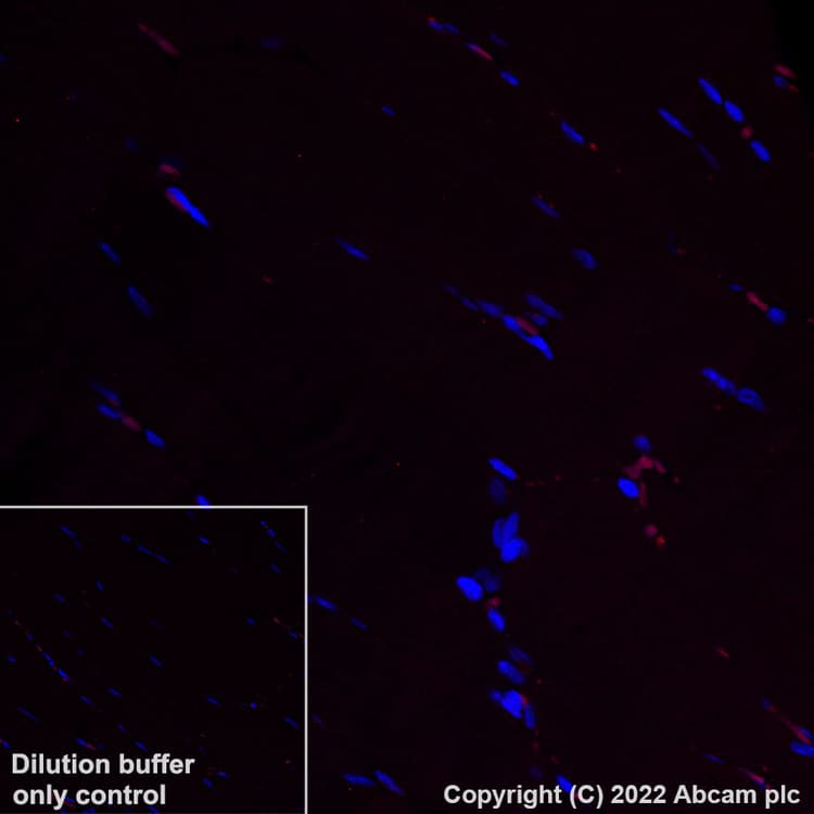 Alexa Fluor® 555 Anti-Aquaporin 5 antibody [EPR3747](AB307863)
