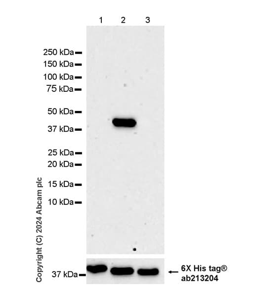 Anti-Adenovirus Type 5 Hexon antibody [EPR28237-57](AB316852)