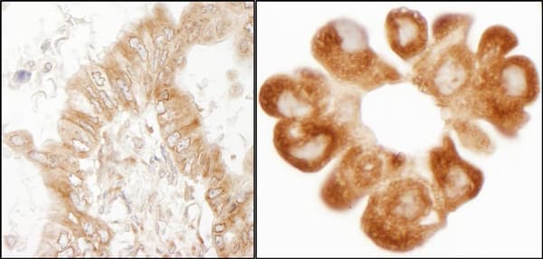 Rpl7 Antibody Ab72550  Immunohistochemistry Formalin Pfa Fixed Paraffin Embedded Sections Img111025