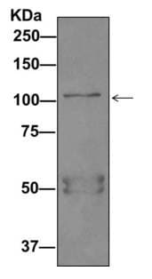 Bicd1 Antibody Epr11642 Bsa And Azide Free Ab249558  Immunoprecipitation Img53482