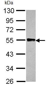 Glycogenin 2 Antibody Ab96359  Western Blot Img162589