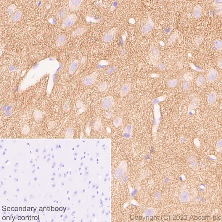 Anti-Calcineurin B/PPP3R1 antibody [EPR24992-18](AB303482)