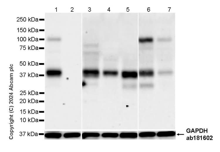 Pai1 Antibody Epr21850 262 Bsa And Azide Free Ab317605  Western Blot Img431716