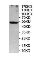 Pstpip1 Antibody Ab197260  Western Blot Img109556