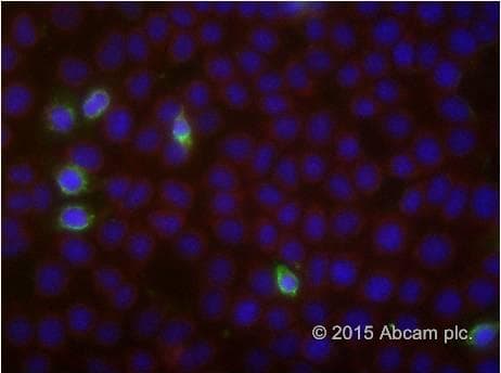 Annexin V-FITC Apoptosis Staining / Detection Kit(AB14085)