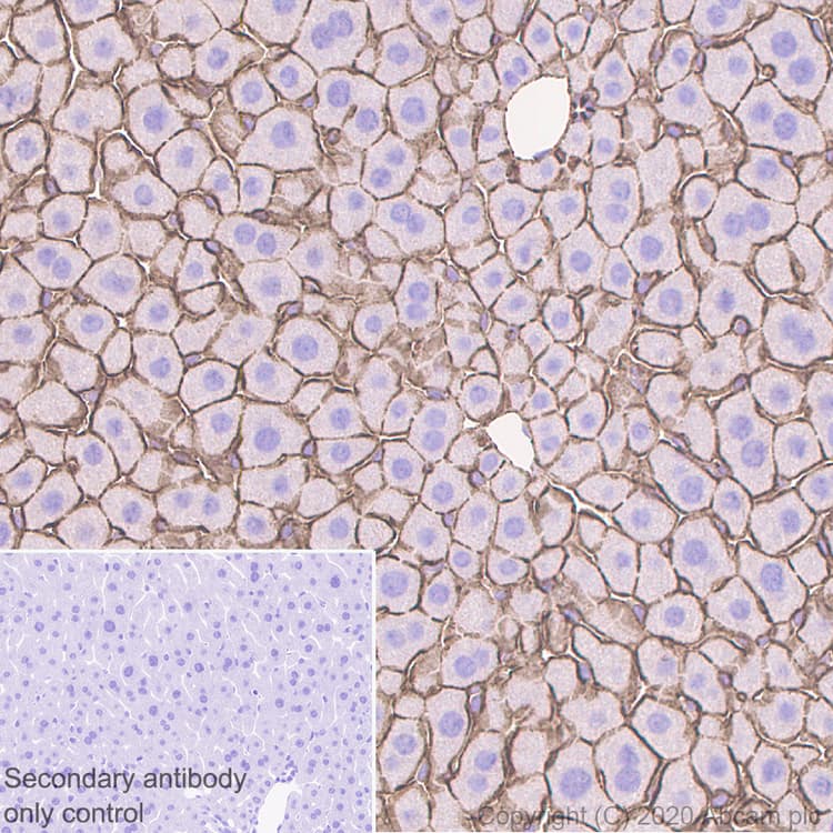Anti-beta Catenin antibody [E247] - ChIP Grade(AB32572)