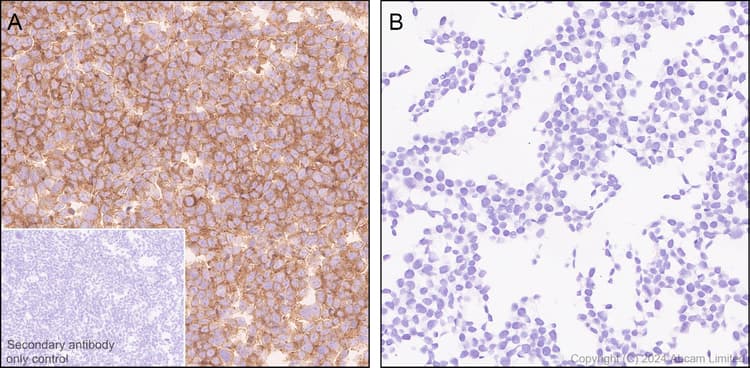 Mtor Antibody Rm1258 Ab322444  Immunohistochemistry Formalin Pfa Fixed Paraffin Embedded Sections Img438200