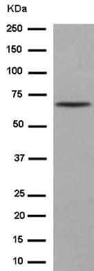 Anti-PHD finger protein 1/PHF1 antibody [EPR14222](AB184951)